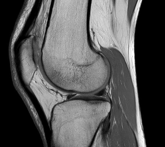 Pamafir Risonanza Magnetica ginocchio