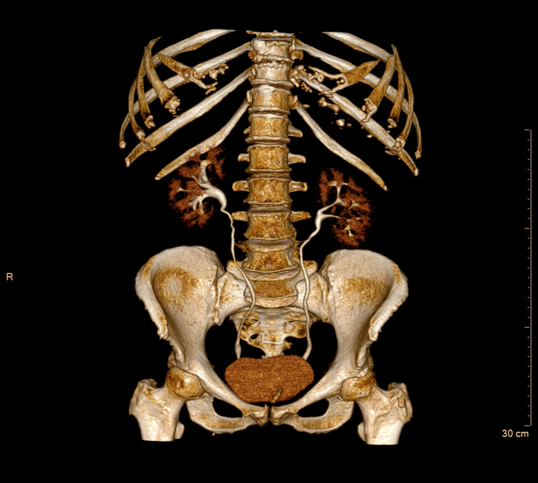 TAC - Tomografia